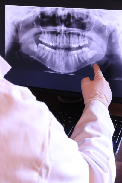 Best Emergency Treatment for Dental Infections or Abscesses in Gasport, NY